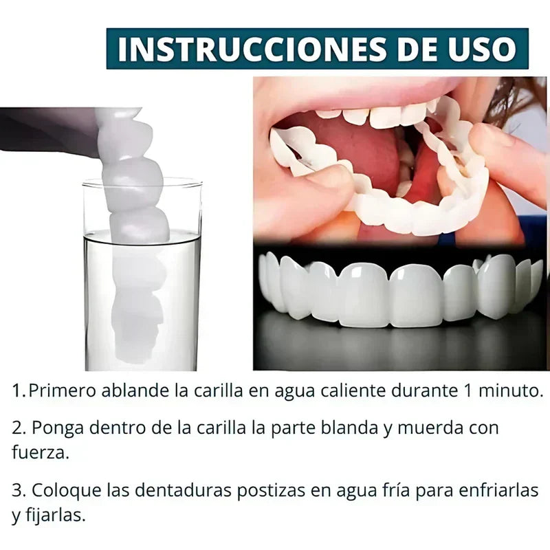 SmilePro 🦷 - Carillas Dentales Ajustables de Resina + ESTUCHE DE REGALO - ¡Últimas unidades!