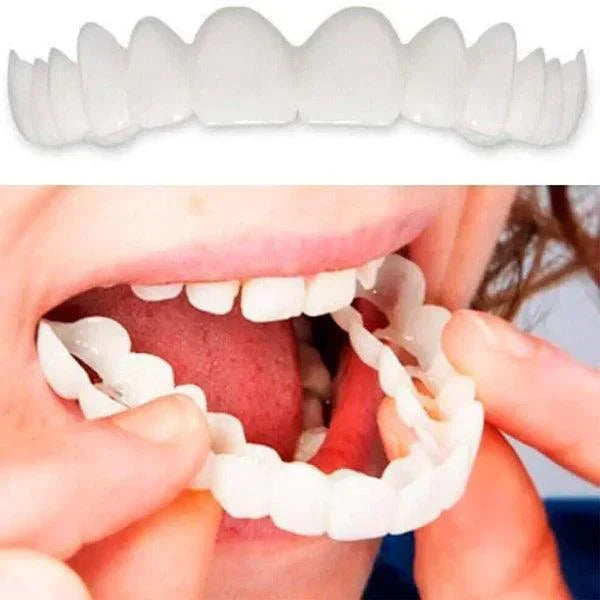 SmilePro 🦷 - Carillas Dentales Ajustables de Resina + ESTUCHE DE REGALO - ¡Últimas unidades!